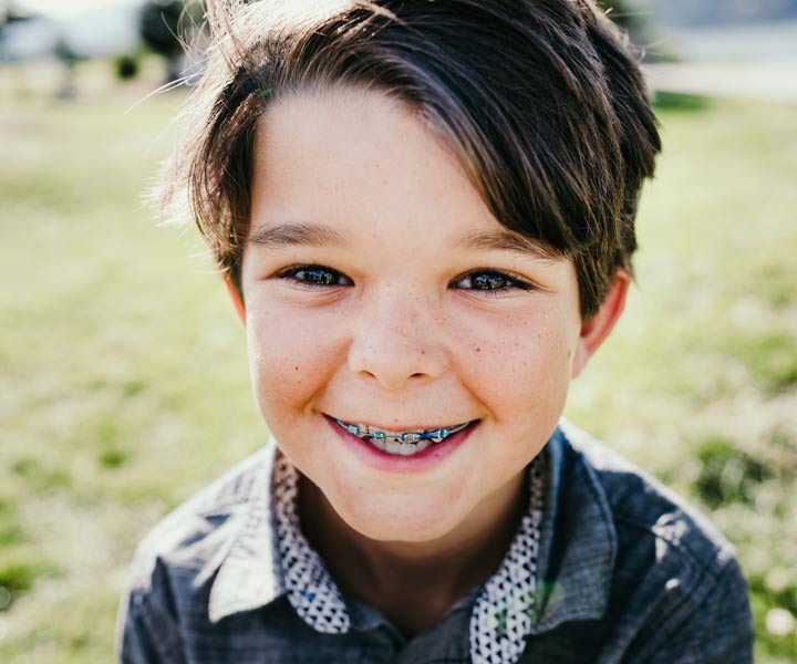 braces for children